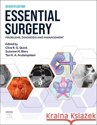Essential Surgery: Problems, Diagnosis and Management Clive R. G. Quick Suzanne Biers Tan Arulampalam 9780443117183
