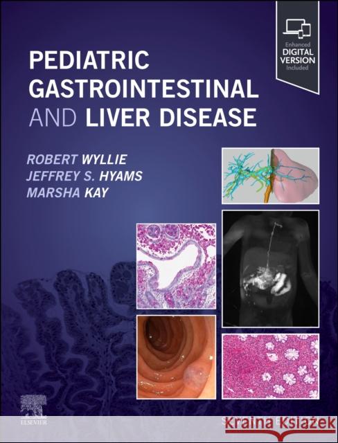 Pediatric Gastrointestinal and Liver Disease Robert Wyllie Jeffrey S. Hyams Marsha Kay 9780443117602 Elsevier