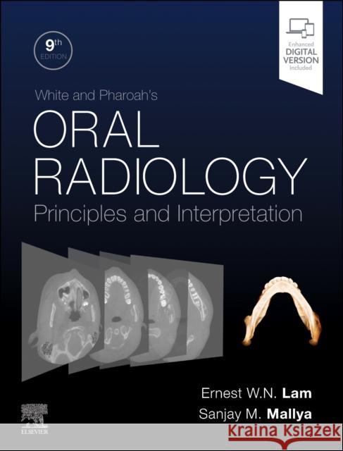 White and Pharoah's Oral Radiology: Principles and Interpretation Ernest Lam Sanjay Mallya 9780443118715 Mosby