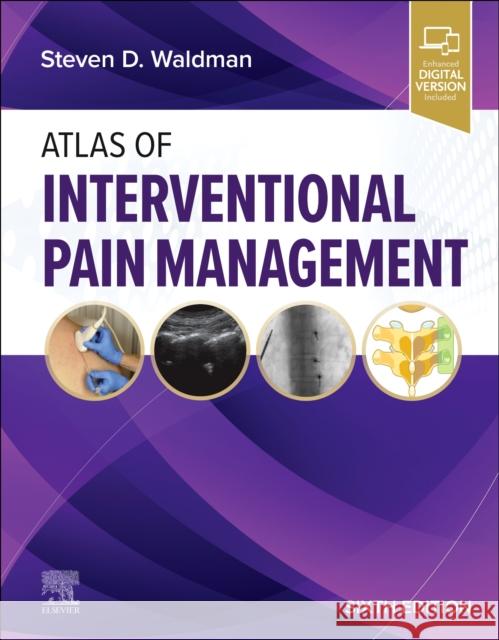 Atlas of Interventional Pain Management Steven D. Waldman 9780443125669 Elsevier
