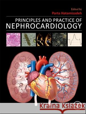 Principles and Practice of Nephrocardiology Parta Hatamizadeh, MD MPH (Assistant Professor of Medicine,<br>Division of Nephrology, Hypertension and Renal Transplant 9780443156663 Elsevier Science Publishing Co Inc
