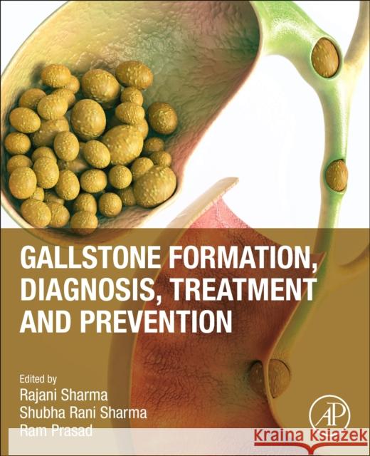 Gallstone Formation, Diagnosis, Treatment and Prevention  9780443160981 Elsevier Science Publishing Co Inc