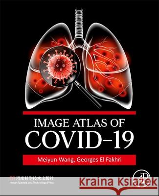 Image Atlas of Covid-19 Meiyun Wang El Fakhri 9780443184932