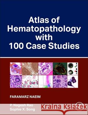 Atlas of Hematopathology with 100 Case Studies Faramarz Naeim P. Nagesh Rao Sophie X. Song 9780443188381 Academic Press