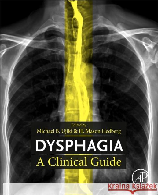 Dysphagia  9780443190636 Elsevier Science Publishing Co Inc