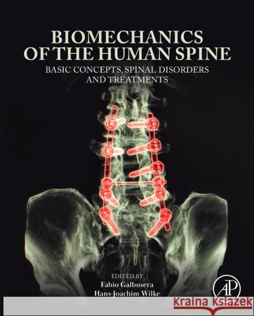 Biomechanics of the Human Spine: Basic Concepts, Spinal Disorders and Treatments Fabio Galbusera Hans-Joachim Wilke 9780443265686 Academic Press