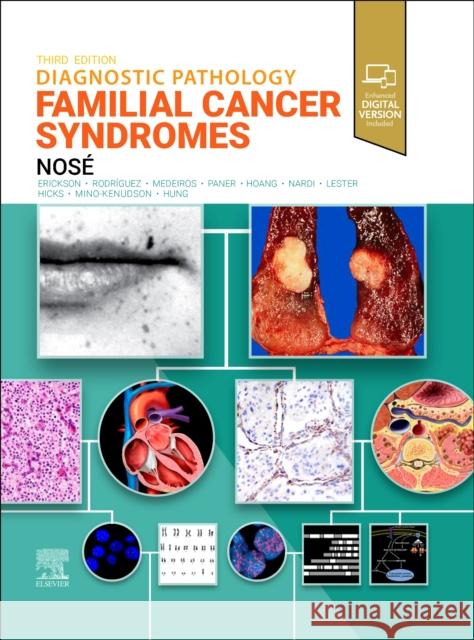 Diagnostic Pathology: Familial Cancer Syndromes Vania, MD, PhD (Professor of Pathology, Harvard Medical School, Pathologist and Consultant in Endocrine Pathology and Fa 9780443286407