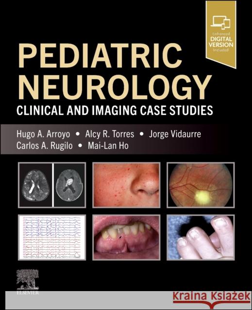 Pediatric Neurology: Clinical and Imaging Case Studies Mai-Lan (Nationwide Children's Hospital, Department of Radiology, Columbus, Ohio) Ho 9780443287220 Elsevier Health Sciences