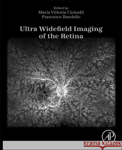 Ultra Widefield Imaging of the Retina Maria Vittoria Cicinelli Francesco Bandello 9780443290848 Academic Press