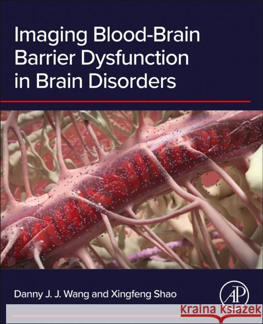 Imaging Blood-Brain Barrier Dysfunction in Brain Disorders Xingfeng, PhD (Assistant Professor of Radiology, Stevens Neuroimaging and Informatics Institute, Keck School of Medicine 9780443329746 Academic Press