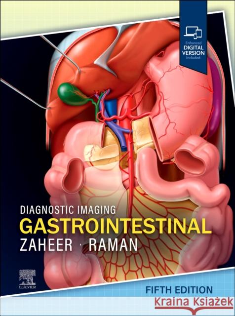 Diagnostic Imaging: Gastrointestinal Siva P. (Bay Imaging Consultants, Walnut Creek, California, USA) Raman 9780443378782 Elsevier