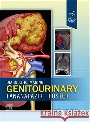 Diagnostic Imaging: Genitourinary Bryan R. Foster Ghaneh Fananapazir 9780443380365 Elsevier