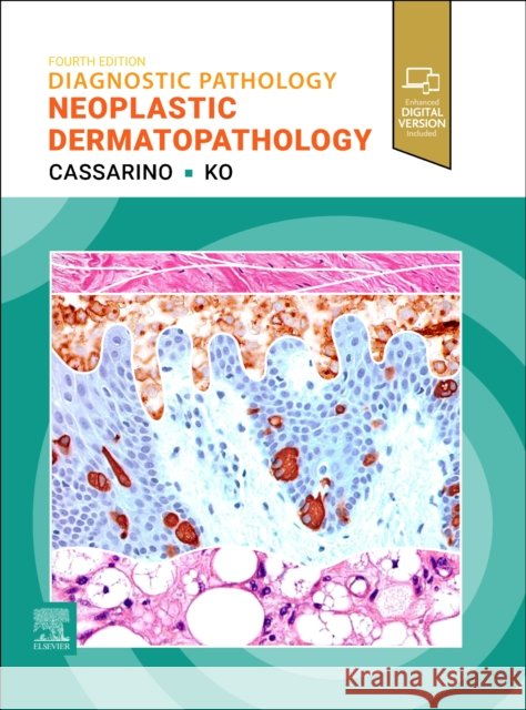 Diagnostic Pathology: Neoplastic Dermatopathology David S. Cassarino Christine J. Ko 9780443410369