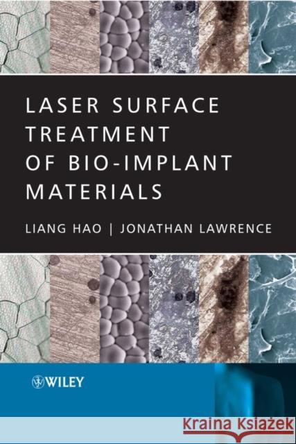 Laser Surface Treatment of Bio-Implant Materials Liang Hao Jonathan Lawrence 9780470016879 John Wiley & Sons