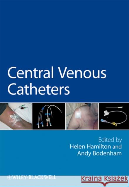 Central Venous Catheters Helen Hamilton 9780470019948