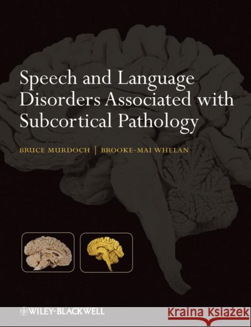 Speech and Language Disorders Associated with Subcortical Pathology Bruce E Murdoch 9780470025734