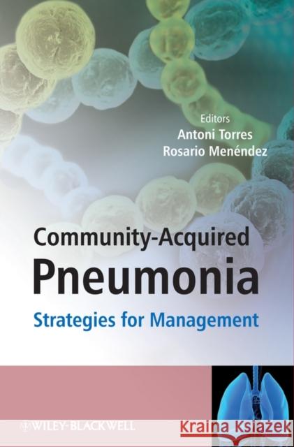 Community-Acquired Pneumonia: Strategies for Management Torres, Antoni 9780470058091 JOHN WILEY AND SONS LTD