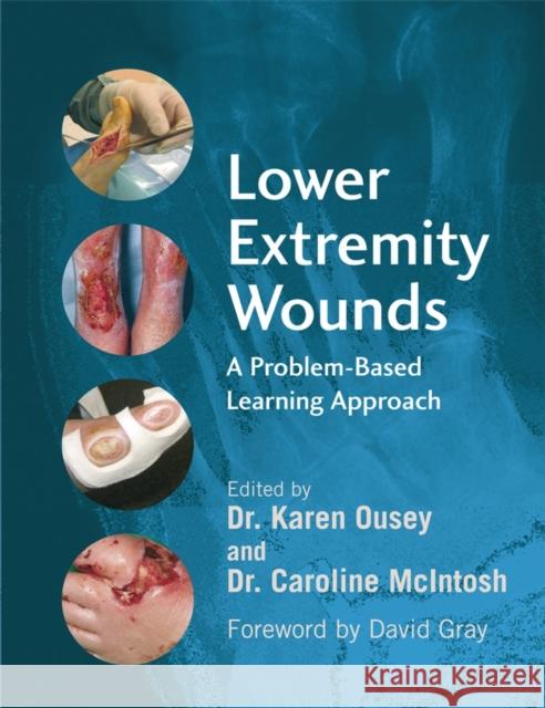 Lower Extremity Wounds: A Problem-Based Approach Ousey, Karen 9780470059081