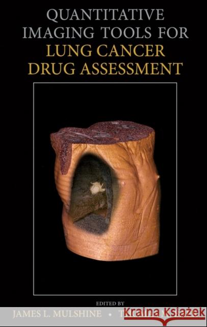 Quantitative Imaging Tools for Lung Cancer Drug Assessment James L. Mulshine Thomas M. Baer Optical Society Of America 9780470118801 John Wiley & Sons