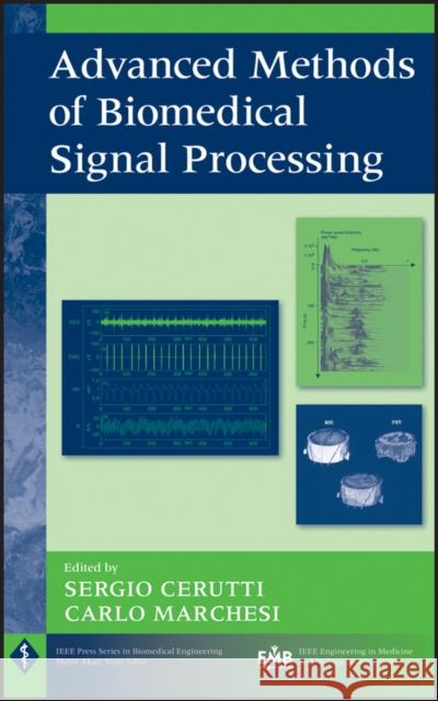 Advanced Methods of Biomedical Signal Processing Patron Editore Sergio Cerutti Carlo Marchesi 9780470422144 IEEE Computer Society Press