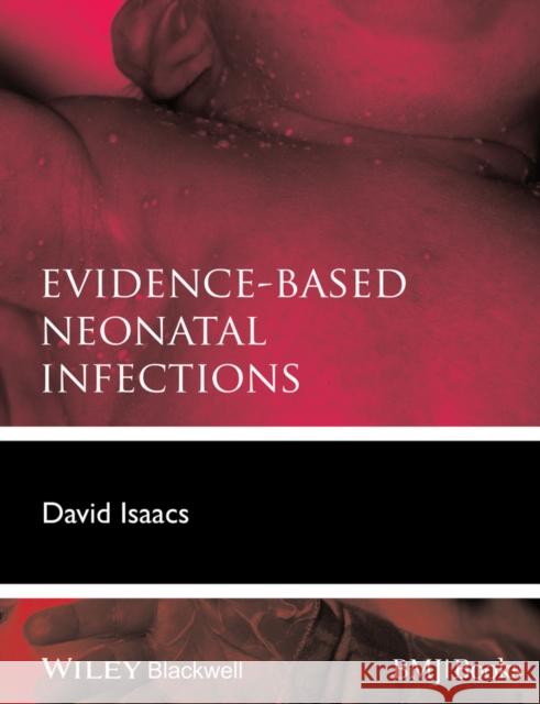 Evidence-Based Neonatal Infections Isaacs, David 9780470654606 John Wiley & Sons