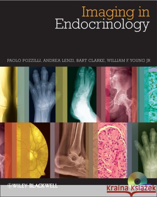 Imaging in Endocrinology Pozzilli, Paolo; Lenzi, Andrea; Clarke, Bart L. 9780470656273