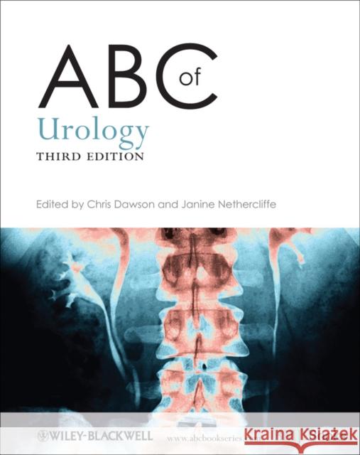 ABC of Urology 3e Dawson, Chris 9780470657171 0