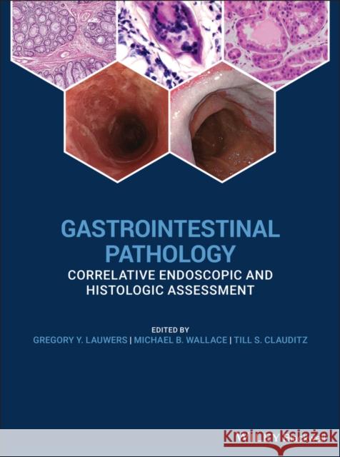 Gastrointestinal Pathology: Correlative Endoscopic and Histologic Assessment Lauwers, Gregory Y. 9780470658369