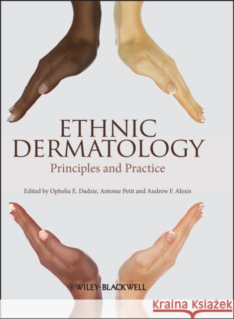 Ethnic Dermatology Dadzie, Ophelia E. 9780470658574