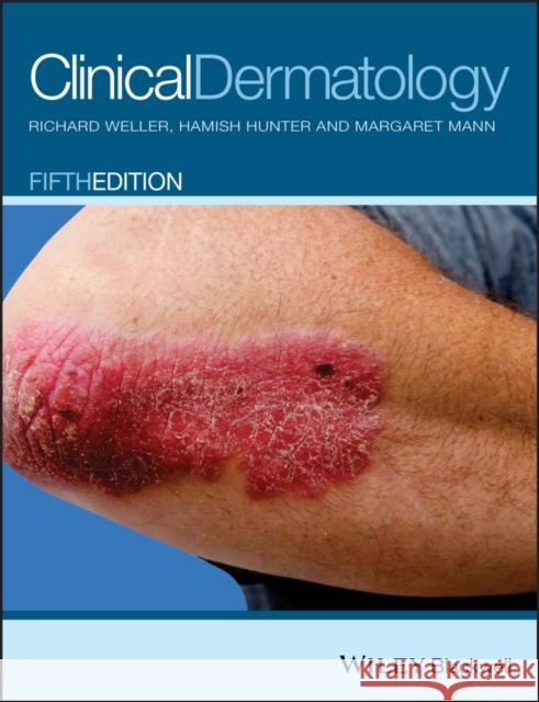 Clinical Dermatology Weller, Richard; Hunter, Hamish; Mann, Margaret W. 9780470659526 John Wiley & Sons