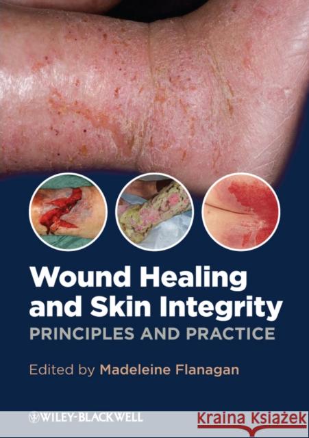 Wound Healing and Skin Integrity: Principles and Practice Flanagan, Madeleine 9780470659779 0