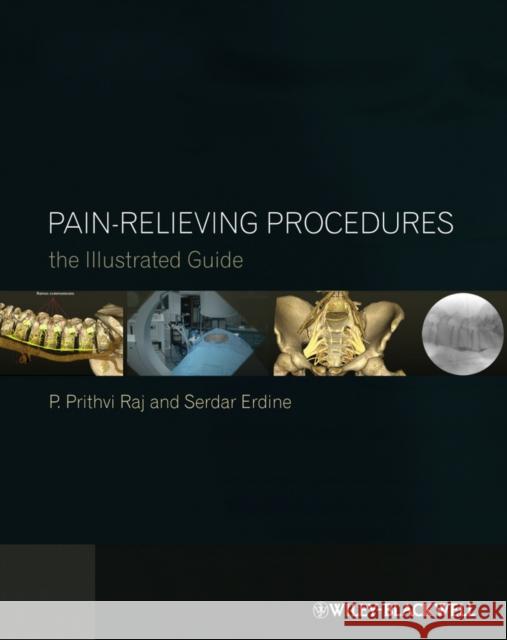 Pain-Relieving Procedures: The Illustrated Guide Erdine, Serdar 9780470670385 Wiley-Blackwell (an imprint of John Wiley & S