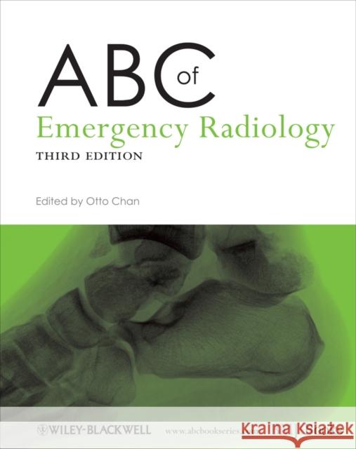 ABC of Emergency Radiology Otto Chan 9780470670934 John Wiley & Sons Inc