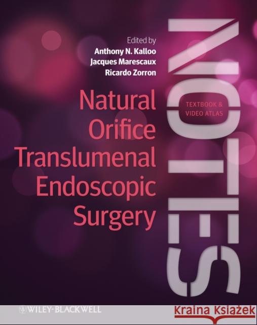 Natural Orifice Translumenal Endoscopic Surgery (Notes) Kalloo, Anthony N. 9780470671030 Wiley-Blackwell