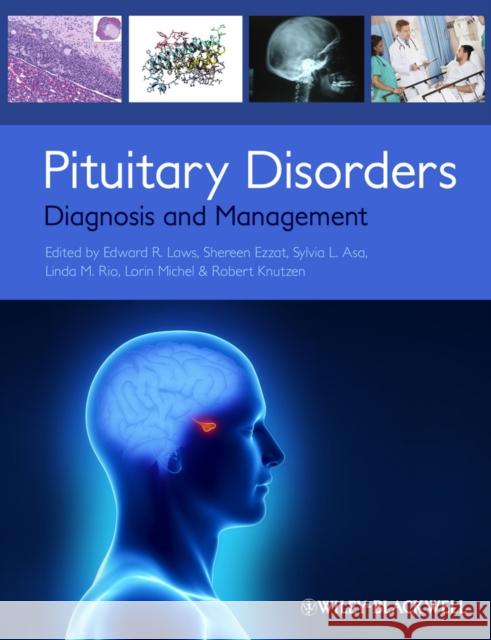 Pituitary Disorders Laws, Edward R. 9780470672013