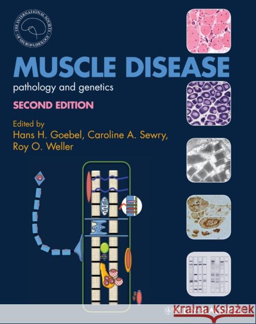 Muscle Disease Goebel, Hans H. 9780470672051