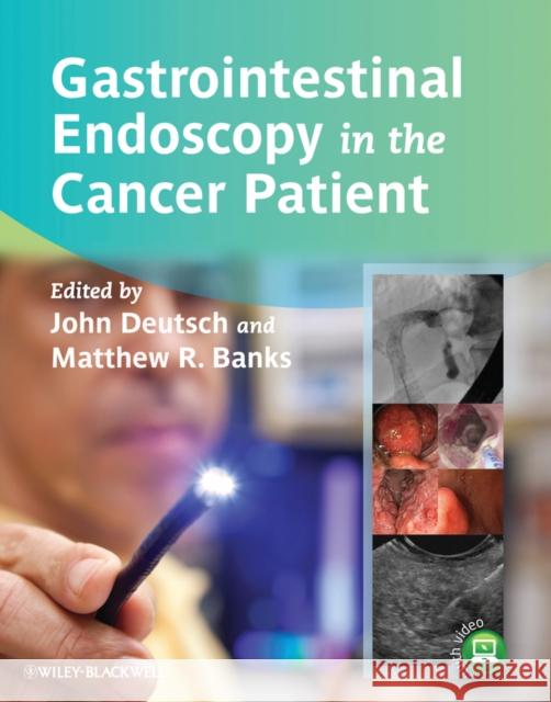 Gastrointestinal Endoscopy in the Cancer Patient John C Deutsch 9780470672464