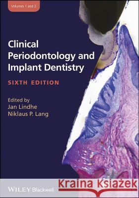 Clinical Periodontology and Implant Dentistry, 2 Volume Set  9780470672488 
