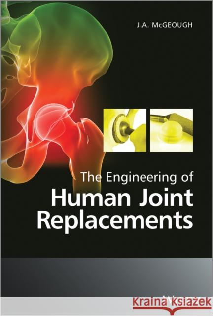 The Engineering of Human Joint Replacements McGeough, Joseph 9780470740279 John Wiley & Sons