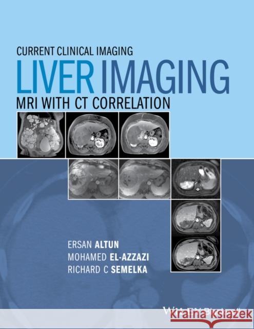 Liver Imaging: MRI with CT Correlation Altun, Ersan 9780470906255 John Wiley & Sons