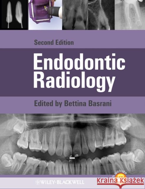 Endodontic Radiology Bettina Basrani 9780470958490 Wiley-Blackwell