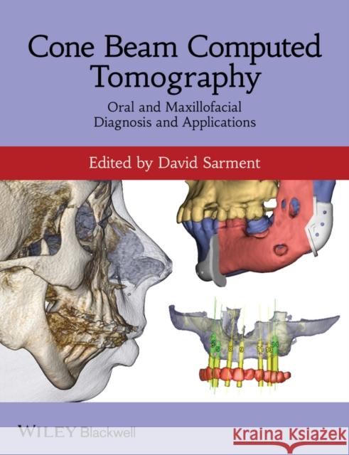 Cone Beam Computed Tomography: Oral and Maxillofacial Diagnosis and Applications Sarment, David 9780470961407 John Wiley & Sons