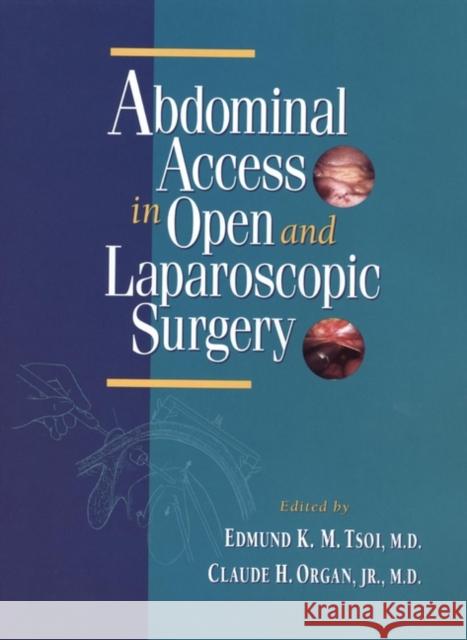 Abdominal Access in Open and Laparoscopic Surgery Edmund K. Tsoi Claude H. Organ 9780471133520 Wiley-Liss