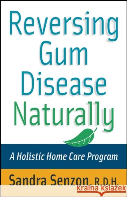 Reversing Gum Disease Naturally: A Holistic Home Care Program Senzon, Sandra 9780471222309 John Wiley & Sons