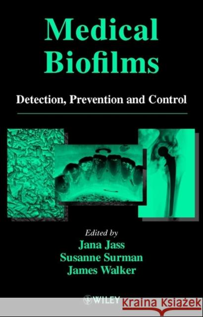 Medical Biofilms: Detection, Prevention and Control Jass, Jana 9780471988670 John Wiley & Sons