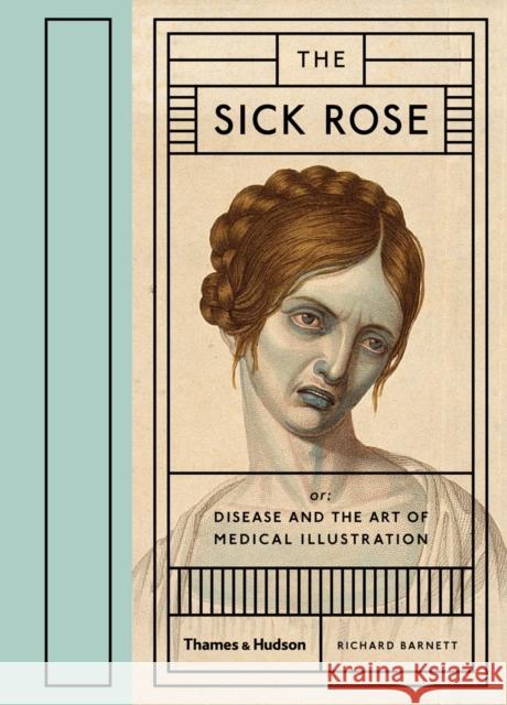 The Sick Rose: Or; Disease and the Art of Medical Illustration Richard Barnett 9780500517345