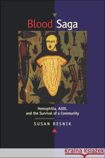 Blood Saga: Hemophilia, Aids, and the Survival of a Community, Updated Edition with a New Preface Resnik, Susan 9780520211957