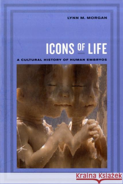 Icons of Life: A Cultural History of Human Embryos Morgan, Lynn 9780520260443 University of California Press