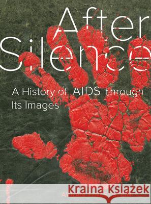 After Silence: A History of AIDS Through Its Images Finkelstein, Avram 9780520295148