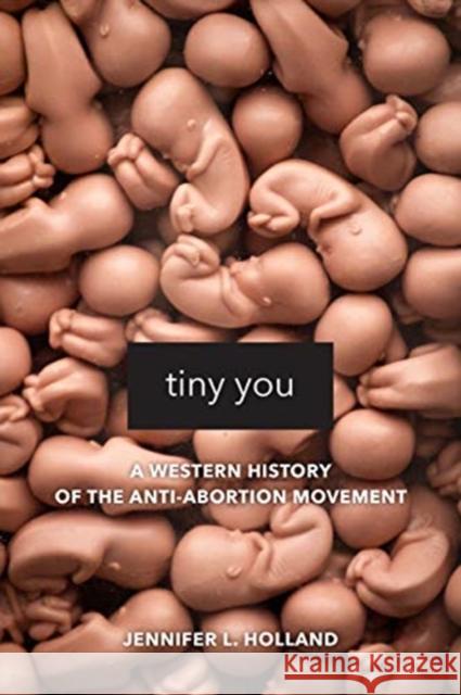 Tiny You: A Western History of the Anti-Abortion Movement Jennifer L. Holland 9780520295865